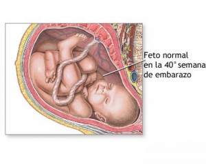 cordon umbilical