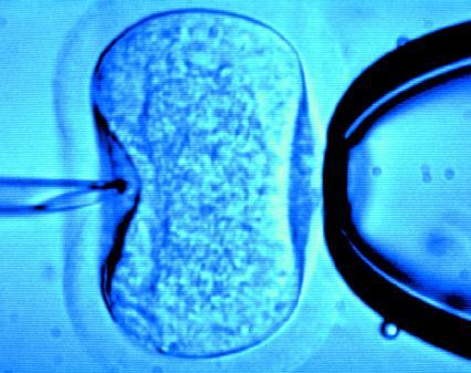 fecundación in vitro