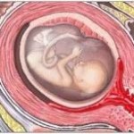 Malformaciones en el embrión producen el aborto espontáneo